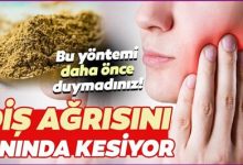 Çürük Diş Ağrısına Ne İyi Gelir?