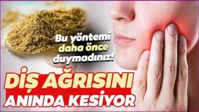 Çürük Diş Ağrısına Ne İyi Gelir?