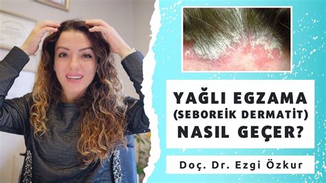 Seboreik Dermatit Hastalığı Nedir, Tedavisi Nasıl Yapılır?