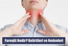 Farenjit Nedir?