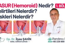 Hemoroid (Basur) Nedir? Belirtileri ve Tedavisi