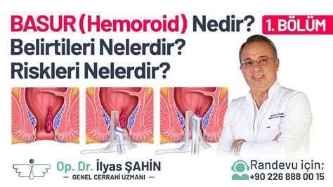 Hemoroid (Basur) Nedir? Belirtileri ve Tedavisi