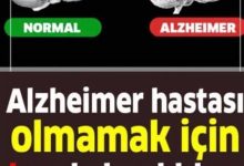 Alzheimer Nedir, Belirtileri Nelerdir?