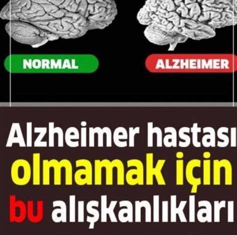 Alzheimer Nedir, Belirtileri Nelerdir?