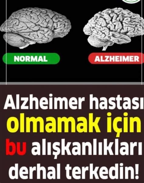 Alzheimer Nedir, Belirtileri Nelerdir?