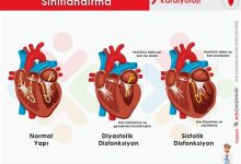 Kalp Yetmezliği