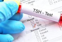 Tiroid Uyarıcı Hormon Testi Nedir? TSH Yüksekliği ve Düşüklüğü