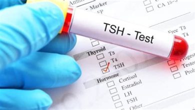 Tiroid Uyarıcı Hormon Testi Nedir? TSH Yüksekliği ve Düşüklüğü